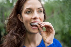 Dentist in Edgware - Dark haired woman placing Invisalign aligners onto her top teeth.