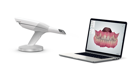 iTero Scanner next to a laptop with a patients teeth on screen