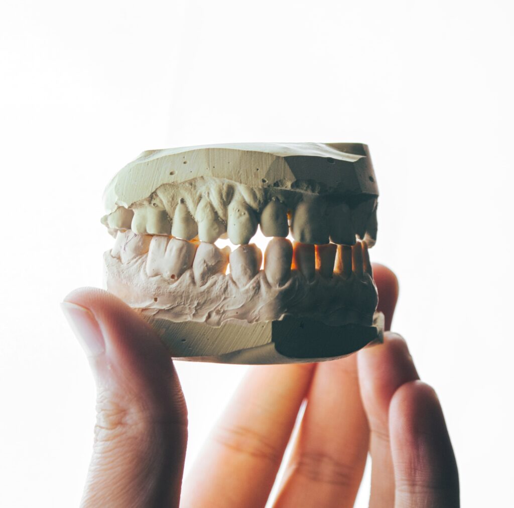 Close-up photo of a hand holding a dental impression of a set of teeth