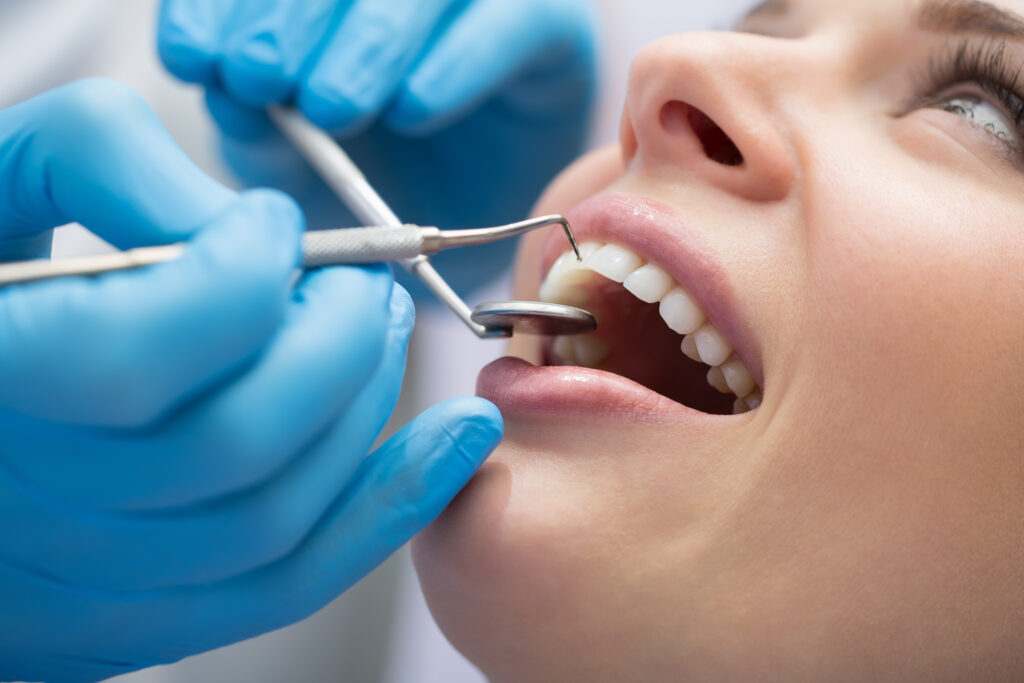 Closeup photo of a woman having dental treatment. the dentist is holding a dental mirror up to her top teeth.