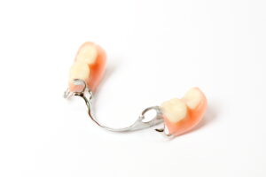 Photo of a partial denture