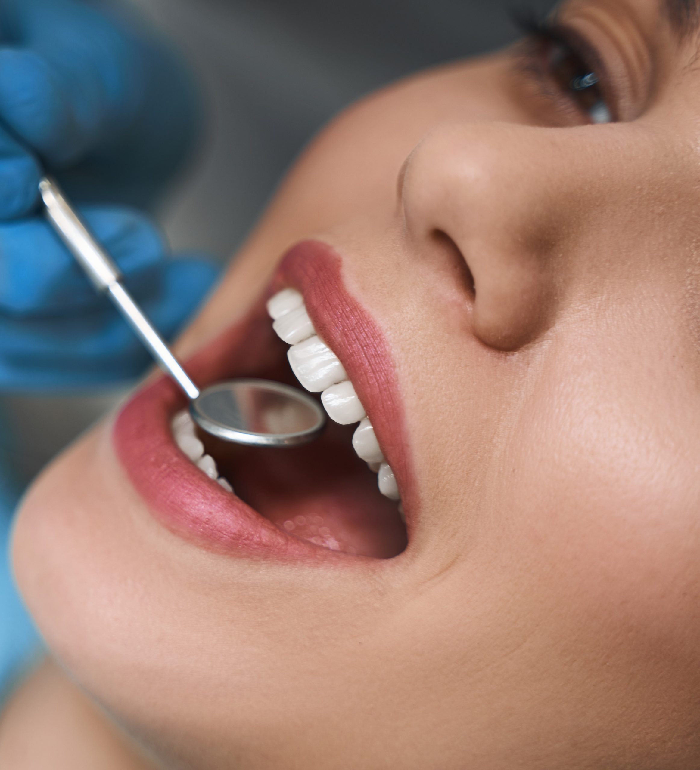 fillings-treatment